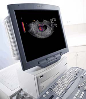 Ultrasound monitor