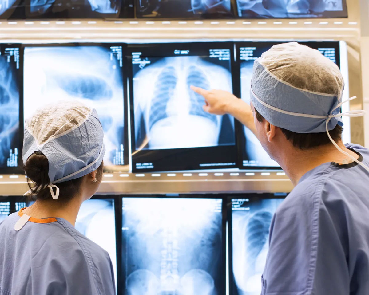 Doctors looking at xrays