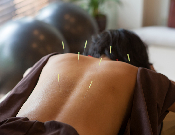 image of pins on a persons back