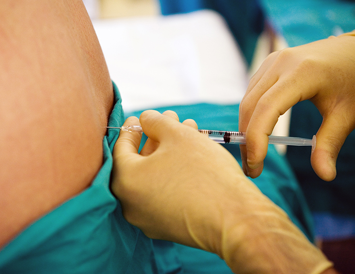 image of provider inserting needle in patient back