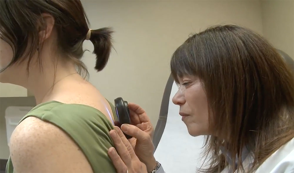 Skin cancer screening by Siteman doctor