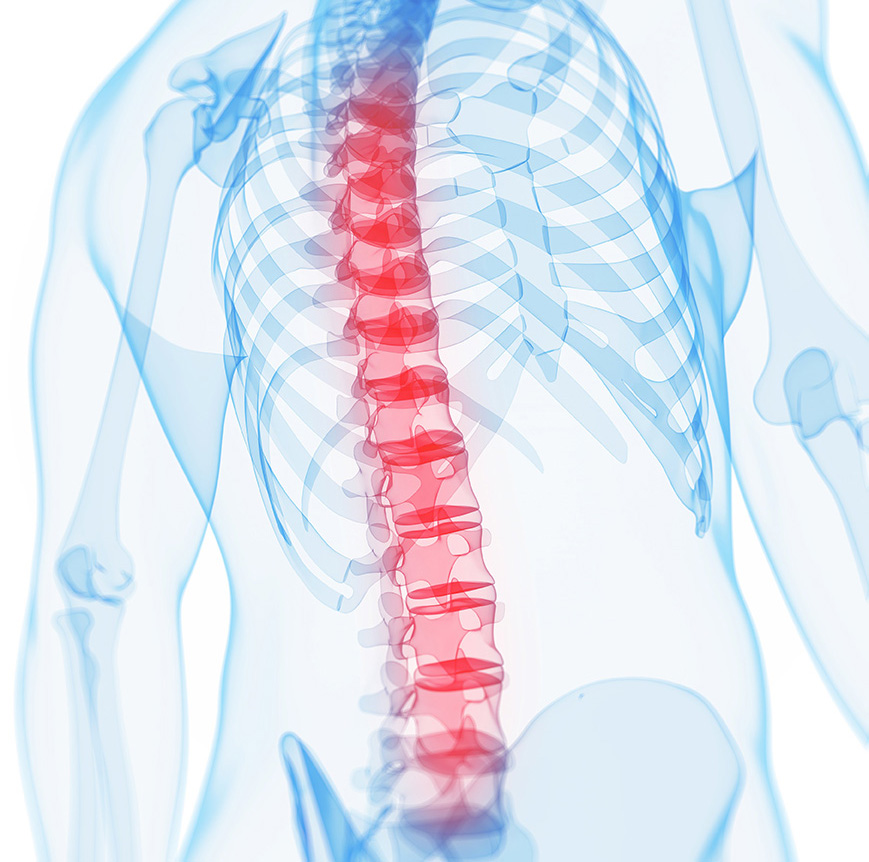 3D medical illustration of a human back with the spine highlighted in red to show the pain areas.