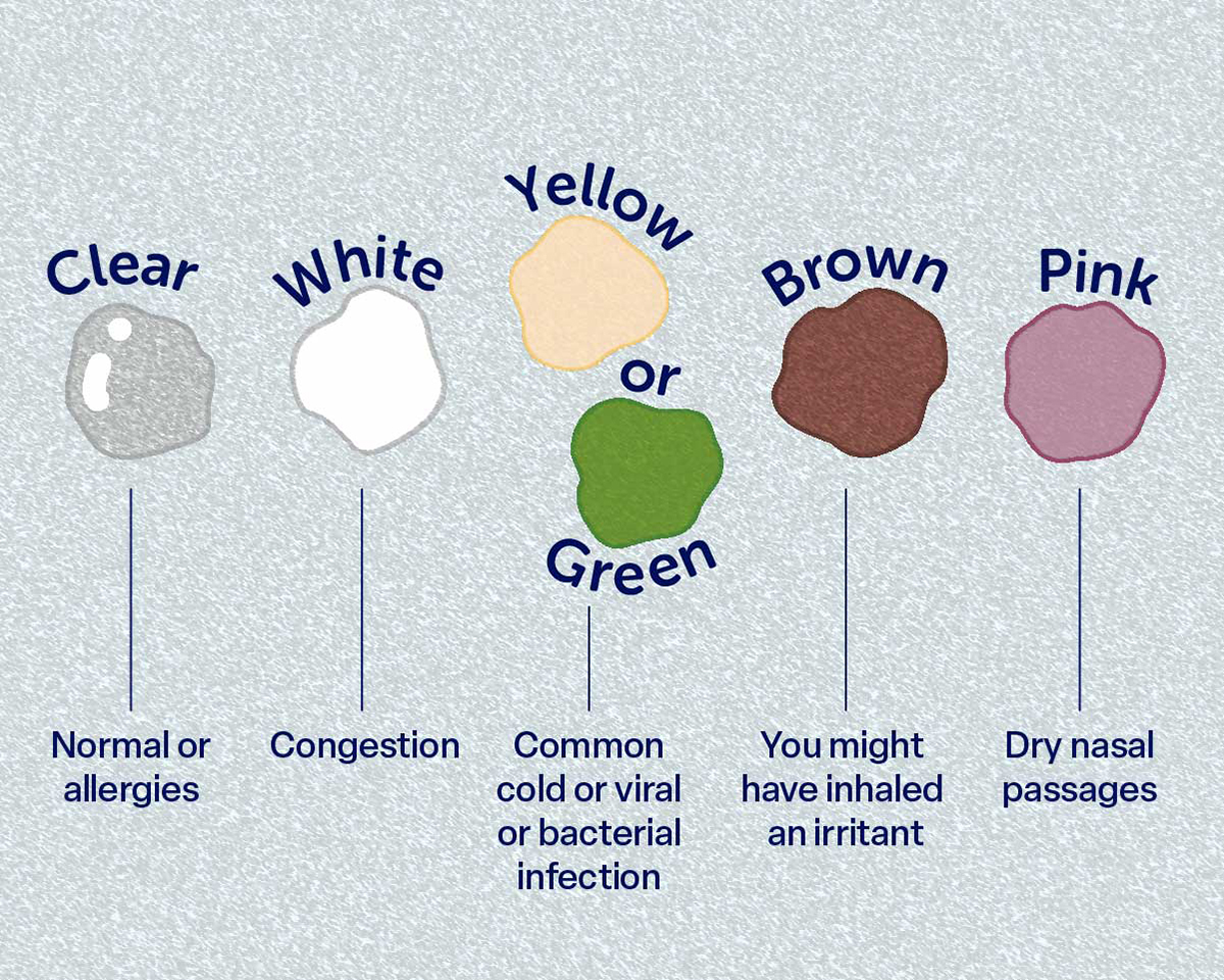 Illustration of snot