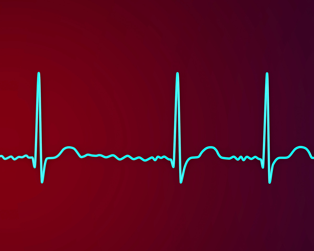 heartbeat flutter afib